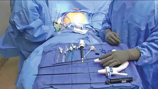The laparoscopy stack system used in UKMMC to perform Keyhole surgery.