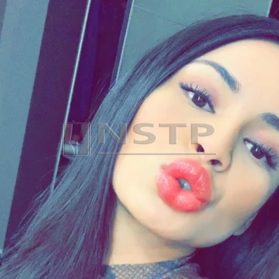Izara Aishah Fuck - Showbiz: I had a lip job, admits Izara
