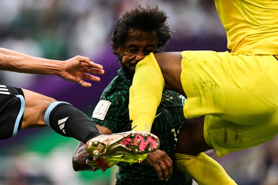 Saudi's Al-Shahrani undergoes surgery after World Cup collision