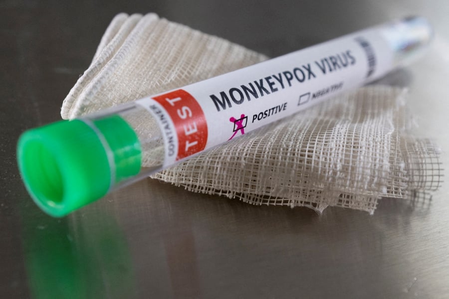 Hungary on Tuesday registered its first case of monkeypox, reported Anadolu Agency.- REUTERS Pic