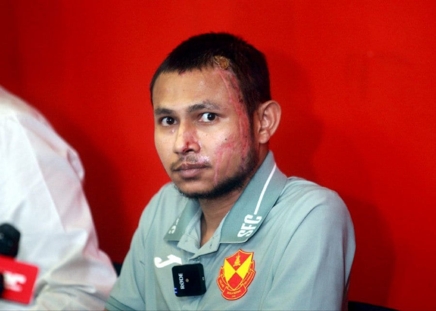  Selangor football star Faisal Halim appeared in public for the first time since suffering serious injuries after he was splashed with acid by an unknown assailant on May 5. — NSTP/FAIZ ANUAR