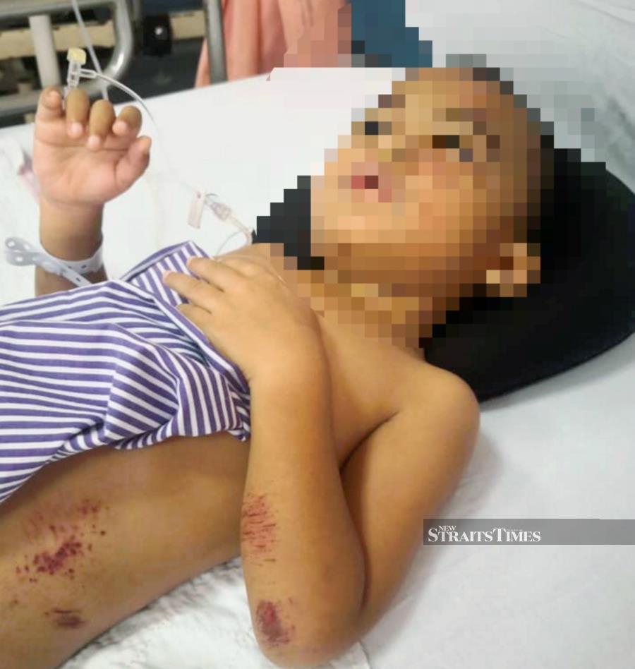 Housewife Nur Aleya Dini Abdullah feared the worst when her four-year-old son was run over by a sports utility vehicle (SUV) during a hit-and-run incident near Serambi Teruntum, here, last Friday. - NSTP/AMIR HAMZAH HUSNI