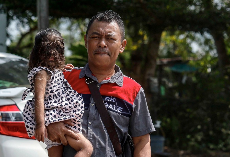 The 2-year-old toddler, who was born with a hairy face and body due to congenital generalised hypertrichosis syndrome (CGH), together with her parents drew attention when they had a brief meeting with Al-Sultan Abdullah and Tunku Azizah when the Kembara Kenali Borneo convoy stopped at the grounds of Al-Falah Mosque, Kampung Penan Muslim Batu 10, Bintulu-Miri on Sept 10. BERNAMA PIC
