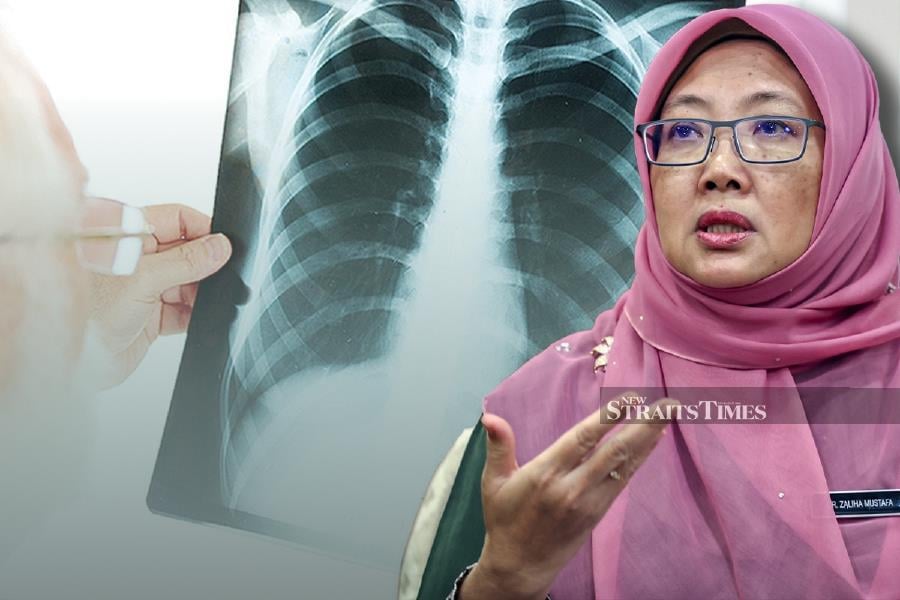 Telling the public not to panic, Health Minister Dr Zaliha Mustafa said the TB situation is “under control”. - NSTP file /Bernama pic