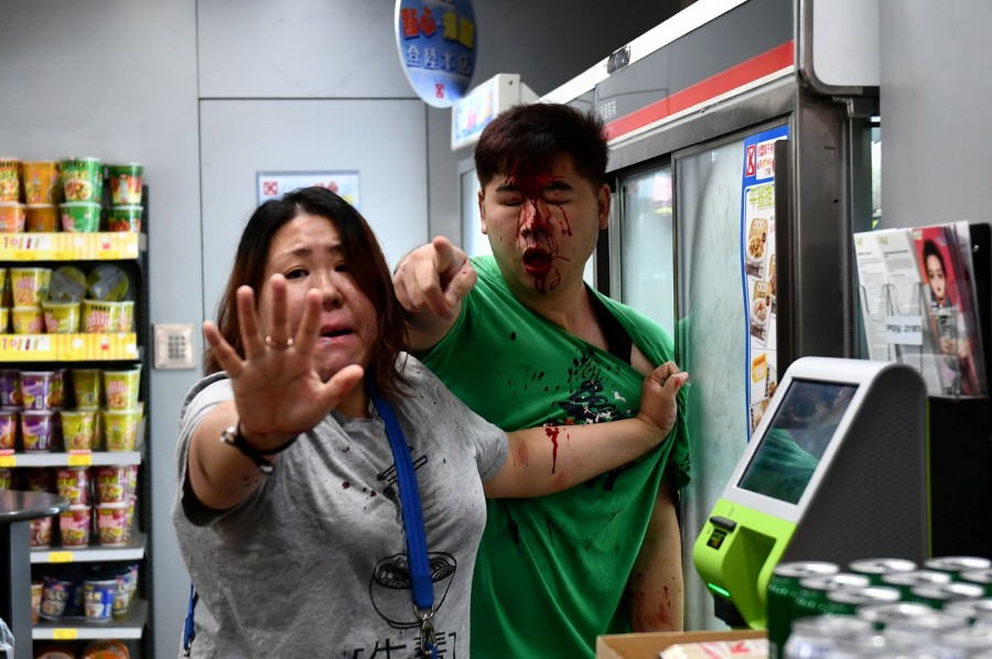 A man who was attacked during scuffle with protesters is helped by a woman as they stand in a convenient store in the Tseung Kwan O area of Kowloon in Hong Kong. - AFP