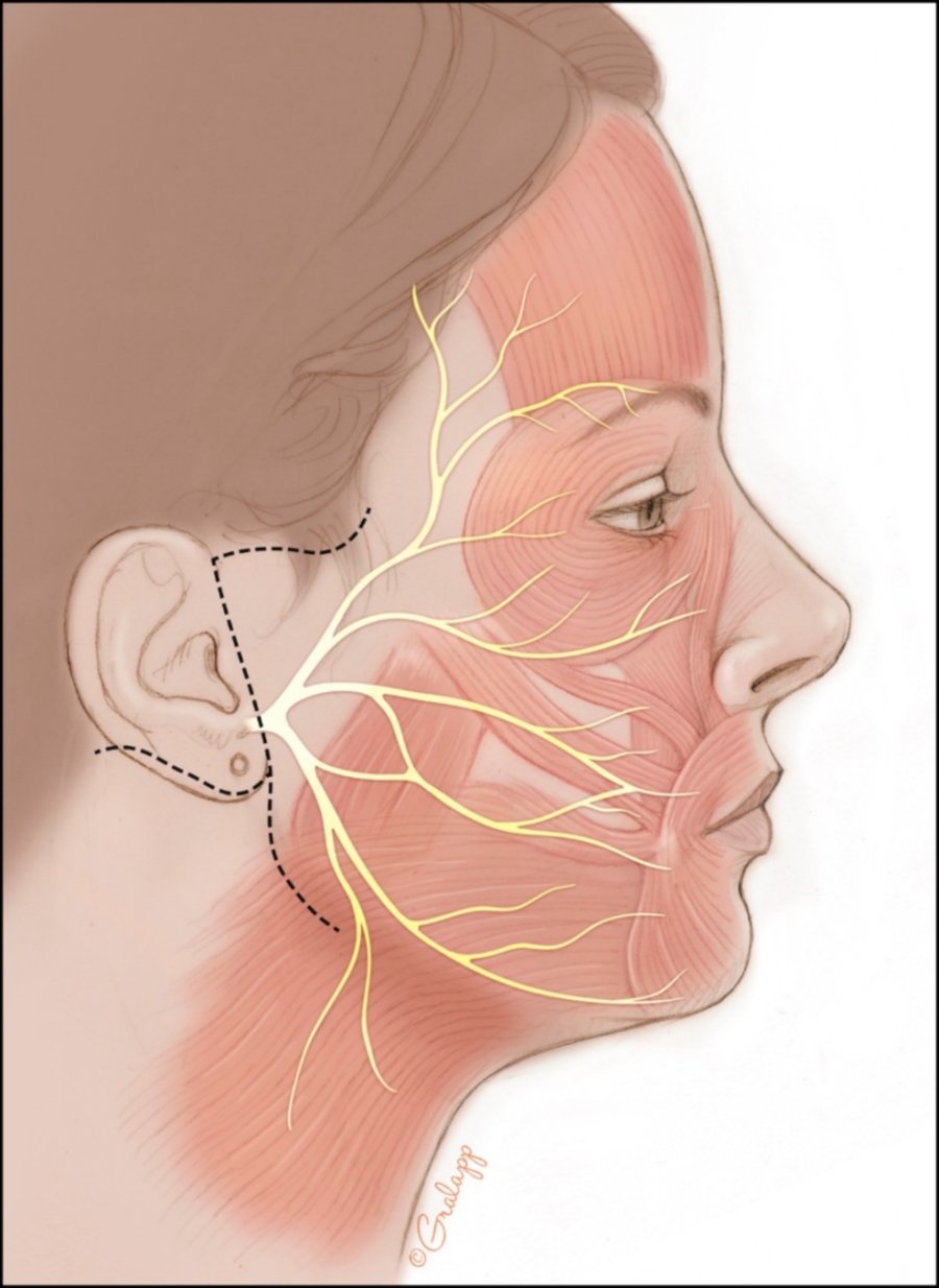 The facial nerve is the 7th cranial nerve and carries nerve fibres that control facial movement and expression. It also carries nerves that are involved in taste to the anterior two-thirds of the tongue where taste buds for sweetness and saltiness are located. - Pic credit: Stanford Medicine