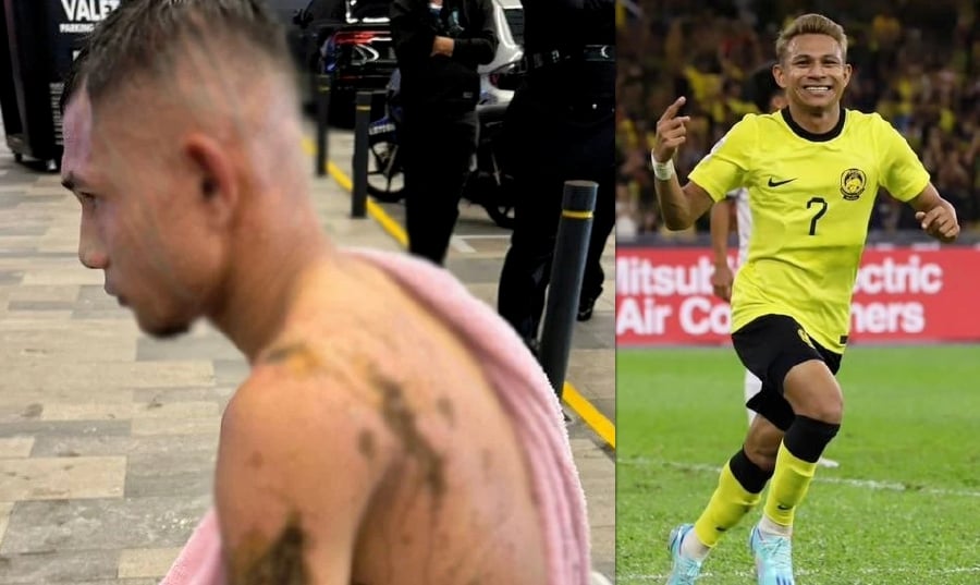 National footballer Faisal Halim was splashed with concentrated sulphuric acid, causing him to suffer fourth-degree burns to several parts of his body, including his face. — NSTP