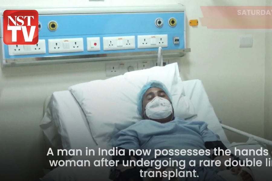 A man in India now possesses the hands of a woman after undergoing a rare double limb transplant.
