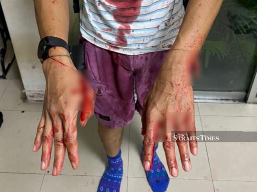 A man’s daily pre-dawn jog around his Shah Alam neighbourhood turned awry yesterday after he was slashed repeatedly by an assailant armed with parang. - Pic credit X/Zarapedia
