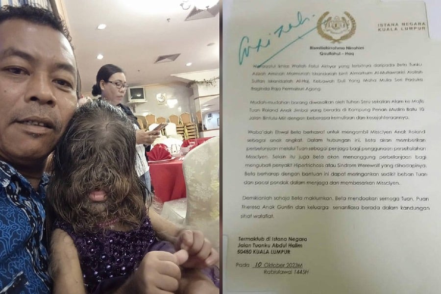 Roland Jimbai, the father of Missclyen, who was born with thick hair on her face and body due to CGH syndrome, expressed his gratitude after reading the content of the letter from Istana Negara. - PIc courtesy from Roland Jimbai