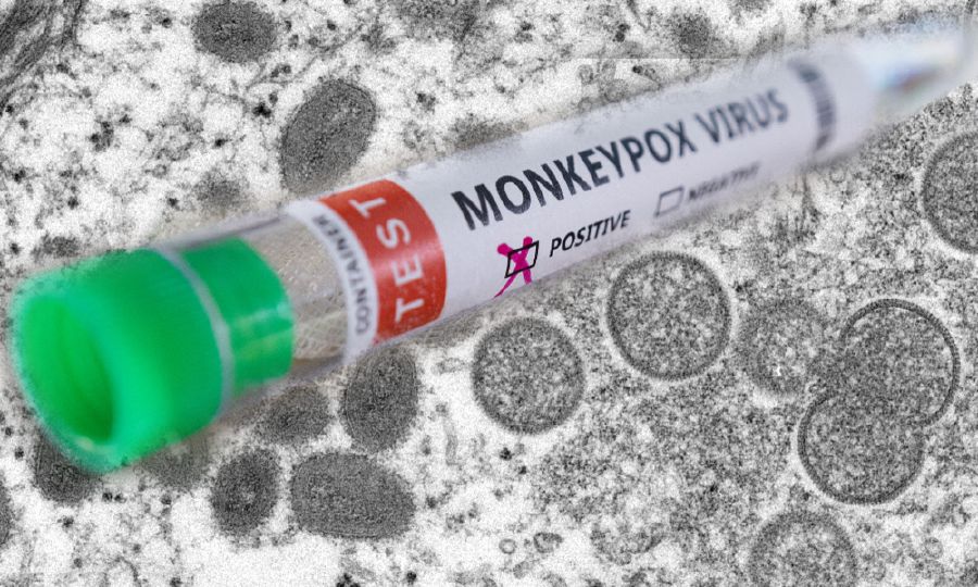 The first monkeypox case in the United States was reported in Massachusetts on Wednesday.