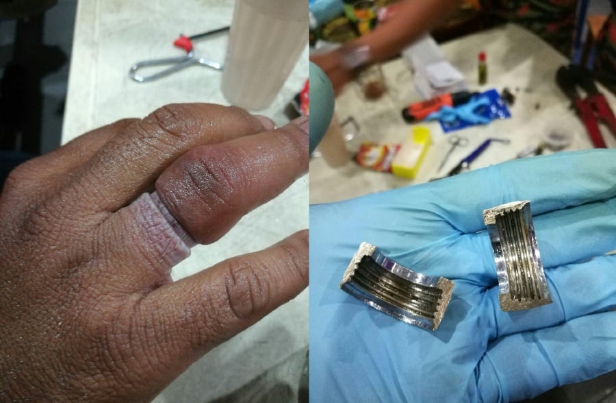 Firefighters safely remove ring stuck on woman's finger | DayakDaily