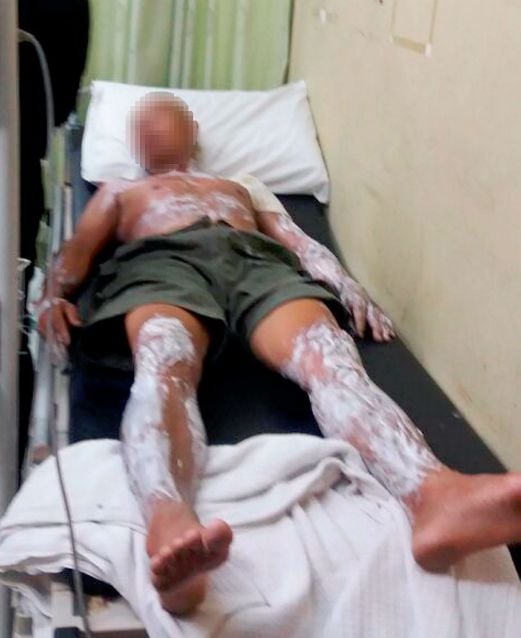 A 60-year-old man suffered serious burns on his body when a cooking gas cylinder caught fire at his house in Nilai Impian here, this morning. Pix by Khairul Najib Asarulah Khan.