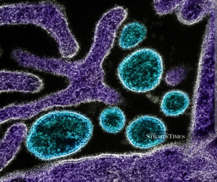  Nipah virus particles in blue.