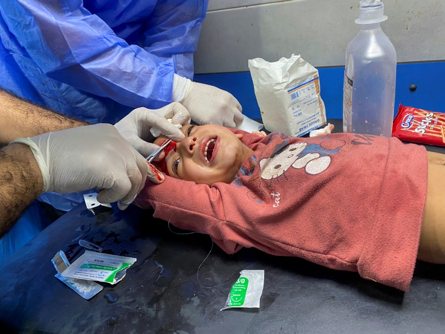 Palestinian girl Orheen Al-Dayah, who was injured in her forehead in an Israeli strike has her wounds stitched without anaesthesia, at Al Shifa hospital in Gaza City, November 8, 2023. -REUTERS/Doaa Rouqa